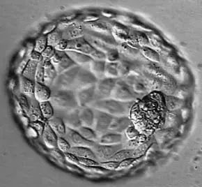 25个卵泡也能促排怀孕,用什么借卵生子代怀试管方案很关键