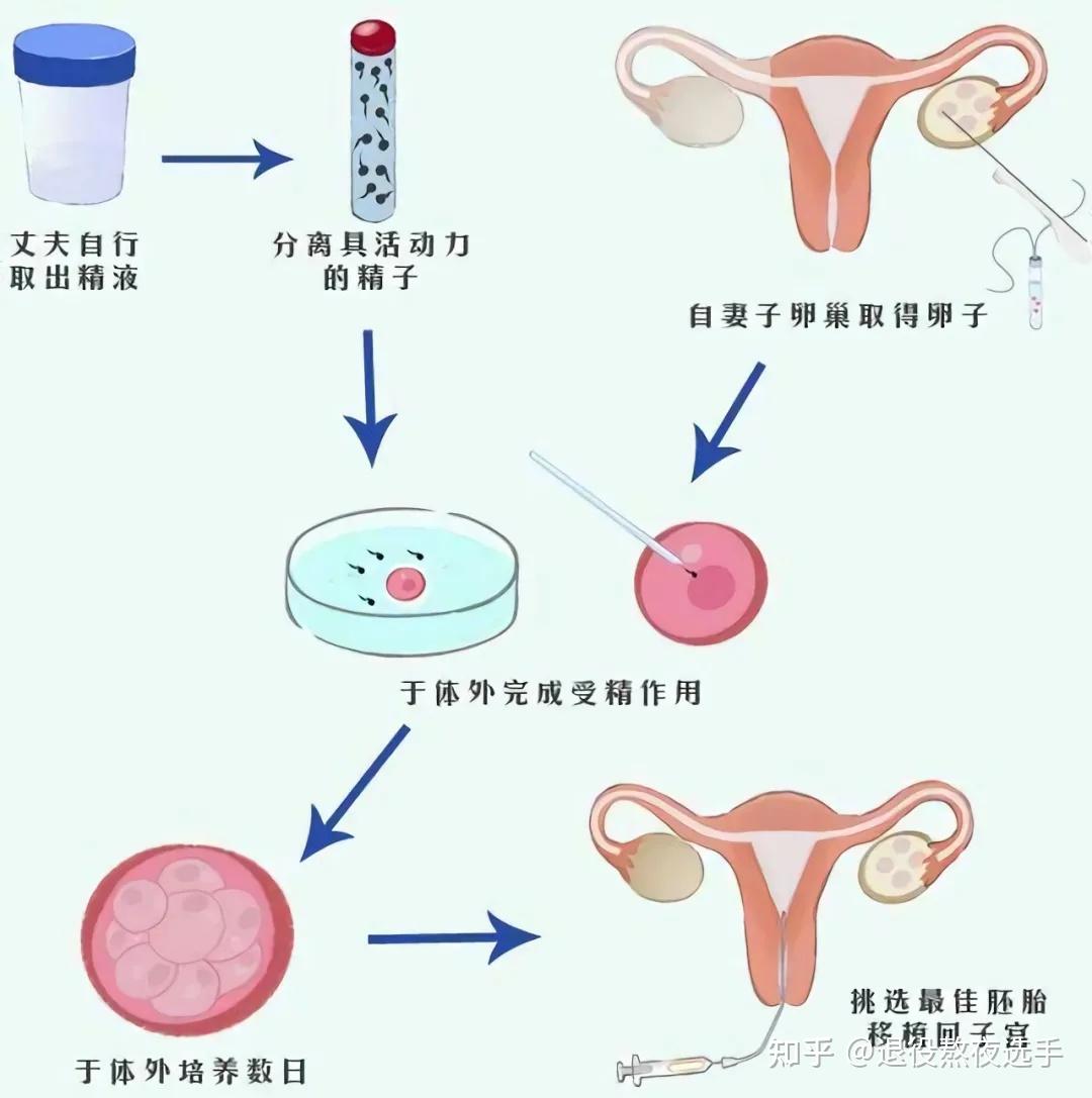 输卵管不通的表现是什么？为什么会出现输卵管不通？