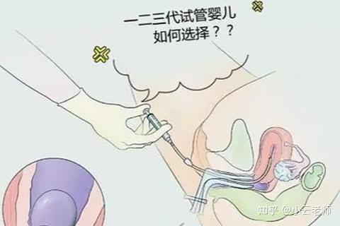 江苏南京市第一人民助孕公司电话婴儿